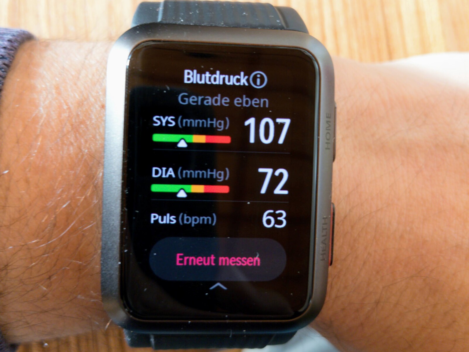 El reloj de Huawei que mide la presión arterial está más cerca de Europa