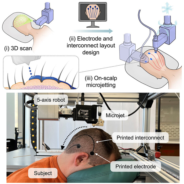 Un microchorro montado en un brazo robótico pulveriza material biocompatible y conductor sobre el cuero cabelludo para formar conexiones eléctricas, en sustitución de un tapón EEG. (Fuente de la imagen: Vasconcelos et al. en Cell Biomaterials)